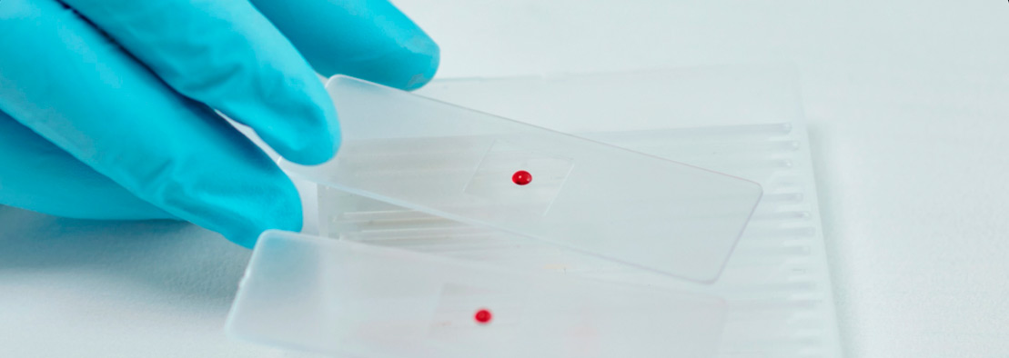 sangre del perfil lípido cardiovascular