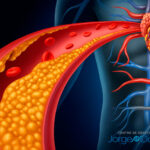 un-marcador-genetico-permite-anticipar-el-riesgo-cardiovascular-oculto-y-prevenir-enfermedades-del-corazon
